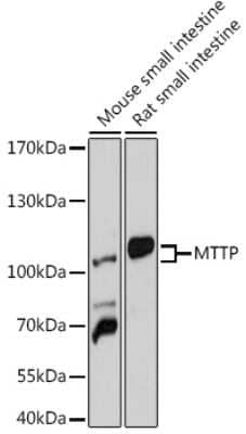 Western Blot: MTTP Antibody [NBP3-04433] - Western blot analysis of extracts of various cell lines, using MTTP antibody (NBP3-04433) at 1:1000 dilution. Secondary antibody: HRP Goat Anti-Rabbit IgG (H+L) at 1:10000 dilution. Lysates/proteins: 25ug per lane. Blocking buffer: 3% nonfat dry milk in TBST. Detection: ECL Basic Kit. Exposure time: 30s.